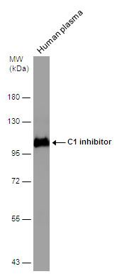 C1 inhibitor Rabbit Polyclonal Antibody