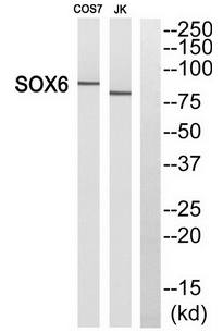 SOX6 antibody