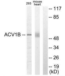 ACV1B antibody