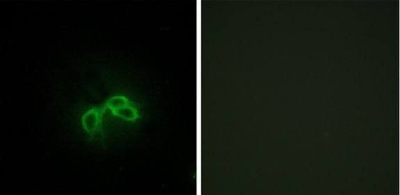 BLCAP Antibody
