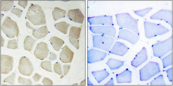 CDKL3 antibody