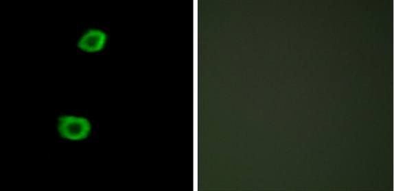 LMTK2 antibody