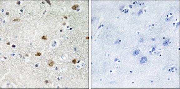 BRF1 Antibody
