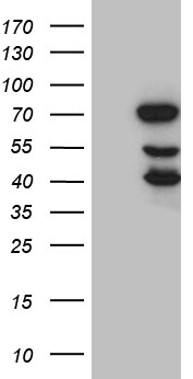 C11orf17 (AKIP1) antibody