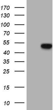 C11orf17 (AKIP1) antibody