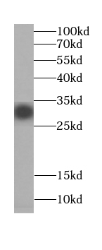 C11orf51 antibody