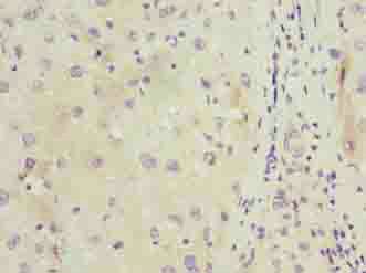 C11orf53 Antibody