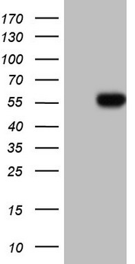C11ORF67 (AAMDC) antibody