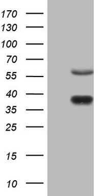 C11ORF67 (AAMDC) antibody