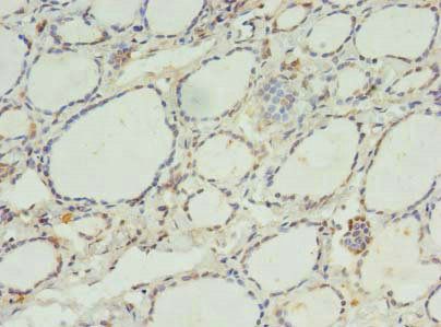 C11orf68 Antibody