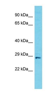 C11orf70 antibody