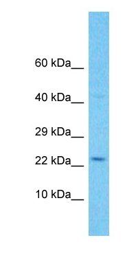 C11orf91 antibody