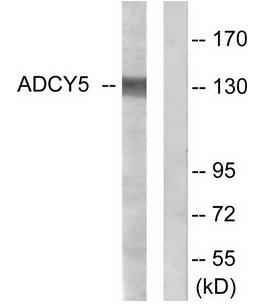 ADCY5/6 Antibody