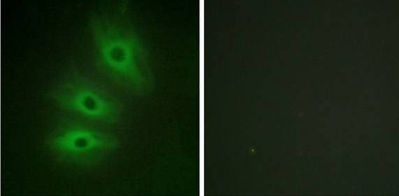ADCY5/6 Antibody