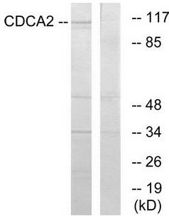 CDCA2 antibody