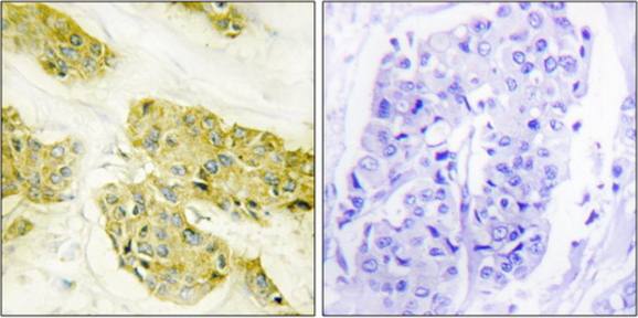 Collagen V alpha 3 antibody