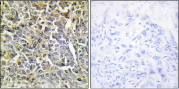 Collagen VI alpha 2 antibody