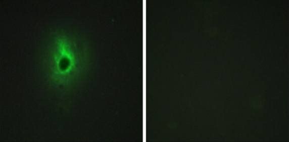 Collagen VI alpha 3 antibody