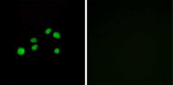 Collagen XXIII alpha 1 antibody