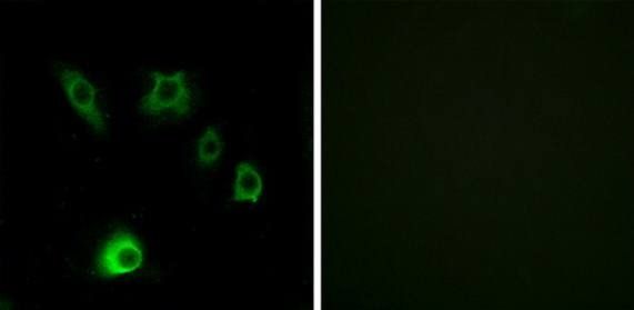 FGF18 antibody