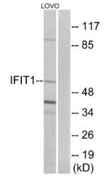 IFIT1 antibody