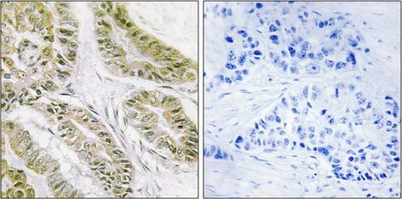 BAX Antibody
