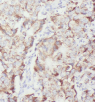 C13orf37 antibody