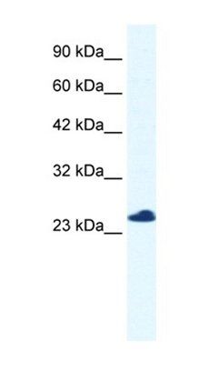C14orf166 antibody