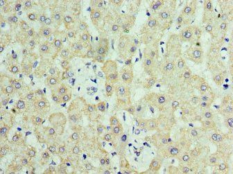 C14orf166 antibody