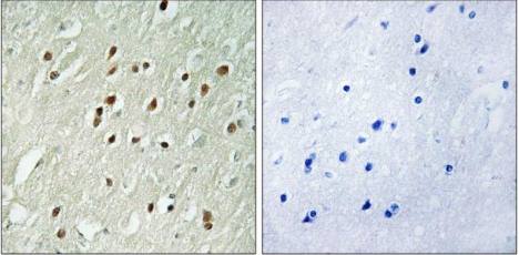 CNTROB Antibody