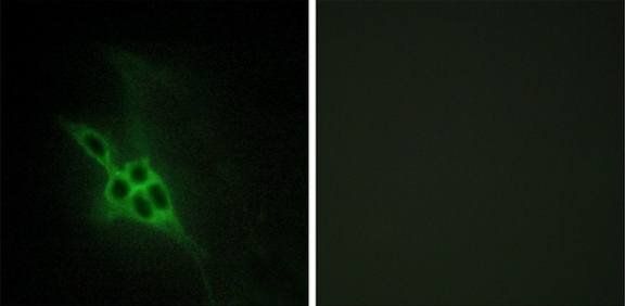 EPHB1/2/3 Antibody