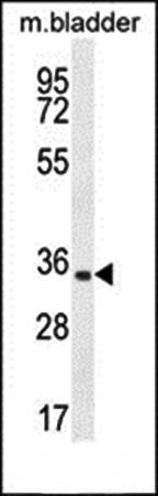 C15orf41 antibody