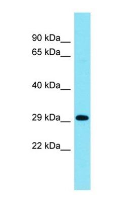 C15orf59 antibody