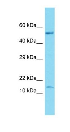 C17orf103 antibody