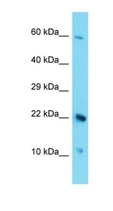 C17orf105 antibody