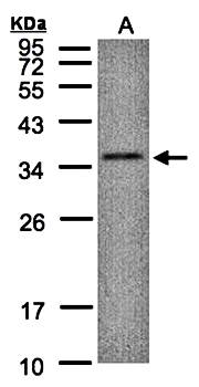 C17orf25 antibody