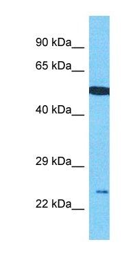C17orf51 antibody
