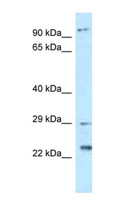 C17orf70 antibody