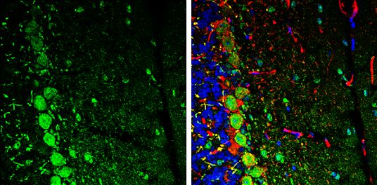 C17orf75 antibody [N1C1]