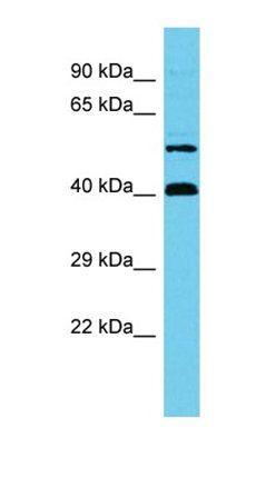 C17orf85 antibody