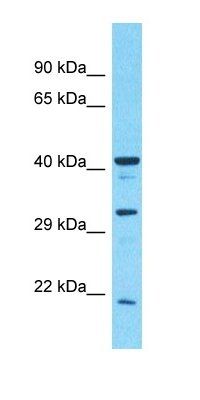 C17orf96 antibody