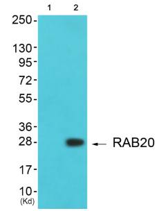 RAB20 Antibody