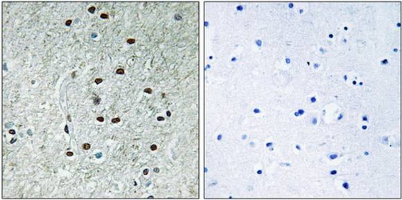 REXO1 Antibody