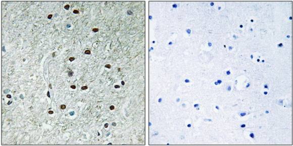 REXO1 antibody