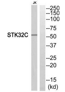 STK32C antibody