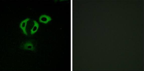 TACC3 antibody