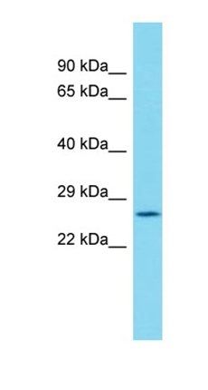 C19orf52 antibody