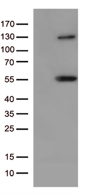 C19orf52 (TIMM29) antibody