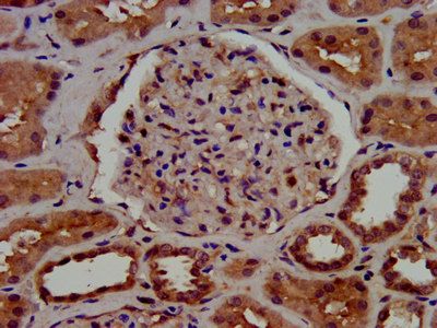 C1GALT1 Antibody