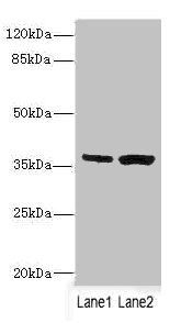 C1GALT1C1 Antibody